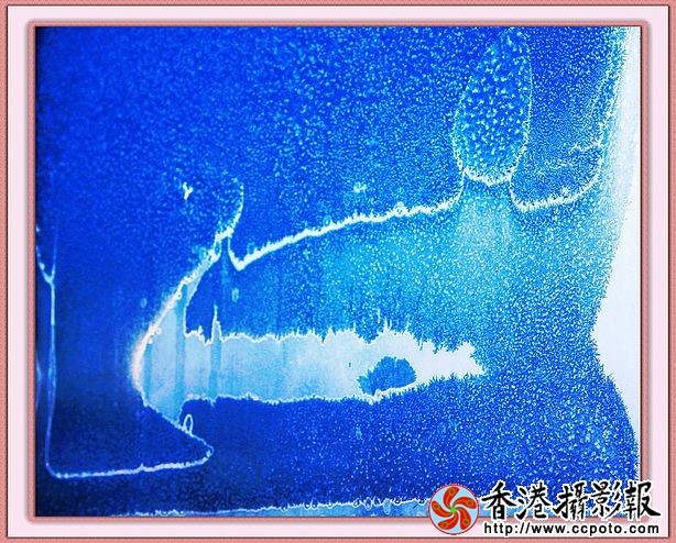人体溶洞